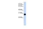 TCEAL4 Antibody in Western Blot (WB)