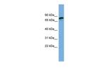 ZNF790 Antibody in Western Blot (WB)