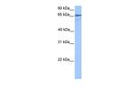 BHMG1 Antibody in Western Blot (WB)