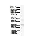 LKAAEAR1 Antibody in Western Blot (WB)