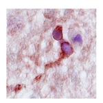 CPLX2 Antibody in Immunohistochemistry (IHC)