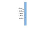 CPLX2 Antibody in Western Blot (WB)