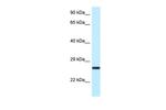 NUDT16 Antibody in Western Blot (WB)