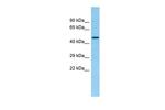 Xxylt1 Antibody in Western Blot (WB)