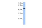 SAMD14 Antibody in Western Blot (WB)