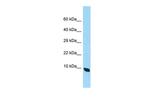 QIL1 Antibody in Western Blot (WB)