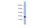 Cystatin M Antibody in Western Blot (WB)