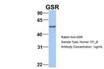 GSR Antibody in Western Blot (WB)