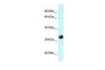 FBXO22 Antibody in Western Blot (WB)