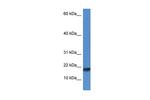 ISCU Antibody in Western Blot (WB)