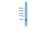 C18orf56 Antibody in Western Blot (WB)