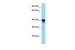 PRPSAP1 Antibody in Western Blot (WB)