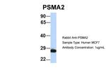 PSMA2 Antibody in Western Blot (WB)