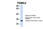 PSMA2 Antibody in Western Blot (WB)