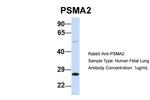 PSMA2 Antibody in Western Blot (WB)