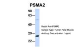 PSMA2 Antibody in Western Blot (WB)