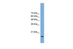 POP5 Antibody in Western Blot (WB)