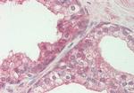 FENS1 Antibody in Immunohistochemistry (Paraffin) (IHC (P))