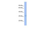 LHPP Antibody in Western Blot (WB)