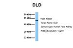 DLD Antibody in Western Blot (WB)