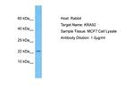 KRTAP9-2 Antibody in Western Blot (WB)