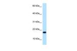 MAGOHB Antibody in Western Blot (WB)