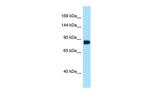 DDIAS Antibody in Western Blot (WB)