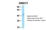 GNA11 Antibody in Western Blot (WB)