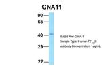 GNA11 Antibody in Western Blot (WB)