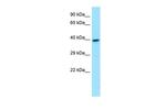 GNA11 Antibody in Western Blot (WB)