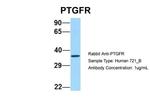 PTGFR Antibody in Western Blot (WB)
