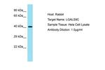 LGALS9C Antibody in Western Blot (WB)