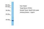 OTOGL Antibody in Western Blot (WB)