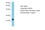 RAB11B Antibody in Western Blot (WB)