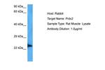 PRDX2 Antibody in Western Blot (WB)