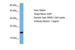 ASIP Antibody in Western Blot (WB)