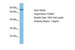 FOXM1 Antibody in Western Blot (WB)