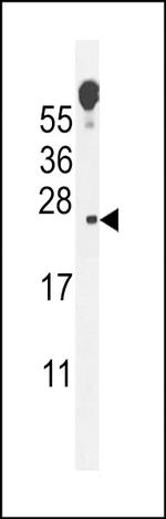 Vopp1 Antibody in Western Blot (WB)