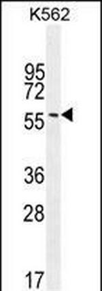 EIF2B4 Antibody in Western Blot (WB)