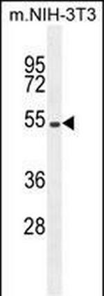 EIF2B4 Antibody in Western Blot (WB)