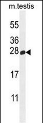 PLD6 Antibody in Western Blot (WB)