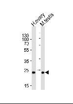 PLD6 Antibody in Western Blot (WB)