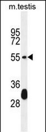 Krt33a Antibody in Western Blot (WB)