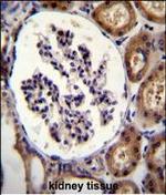 ITGA8 Antibody in Immunohistochemistry (Paraffin) (IHC (P))