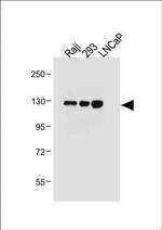 ITGA8 Antibody in Western Blot (WB)