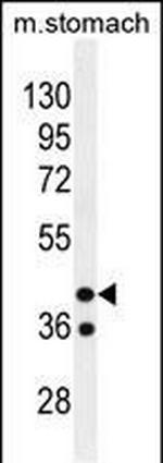 GIN1 Antibody in Western Blot (WB)