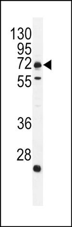 MIC-1 Antibody in Western Blot (WB)