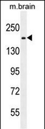 FIP200 Antibody in Western Blot (WB)