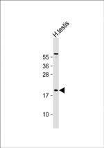 CT45A Antibody in Western Blot (WB)