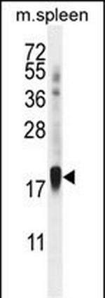 ZNF593 Antibody in Western Blot (WB)